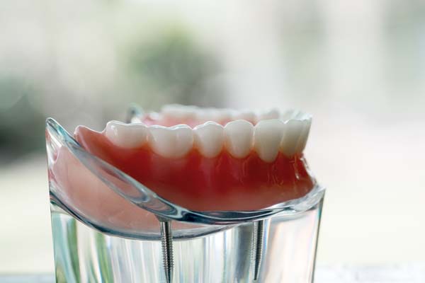 Immediate Dentures Vs Conventional Dentures