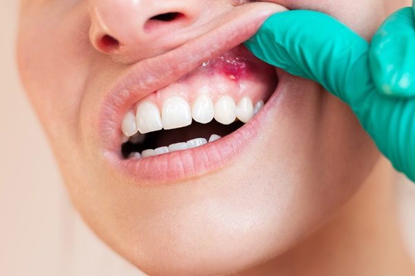 Gum Disease Treatment Options From A General Dentist